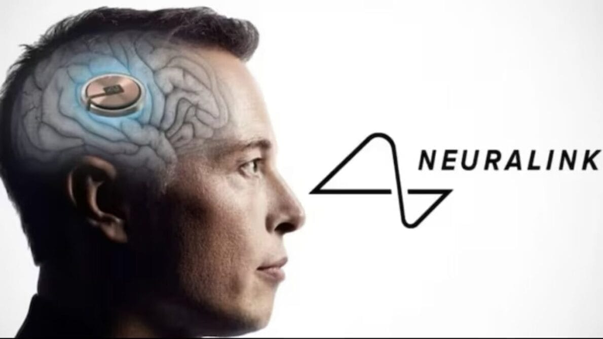 “brain chip”, “neuralink”, “Precision Neuroscience”, “elon musk”, “chips”