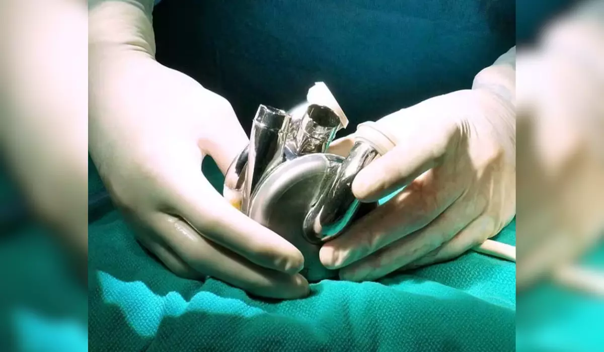 The world's first titanium artificial heart was successfully implanted in a human patient and this changes everything!