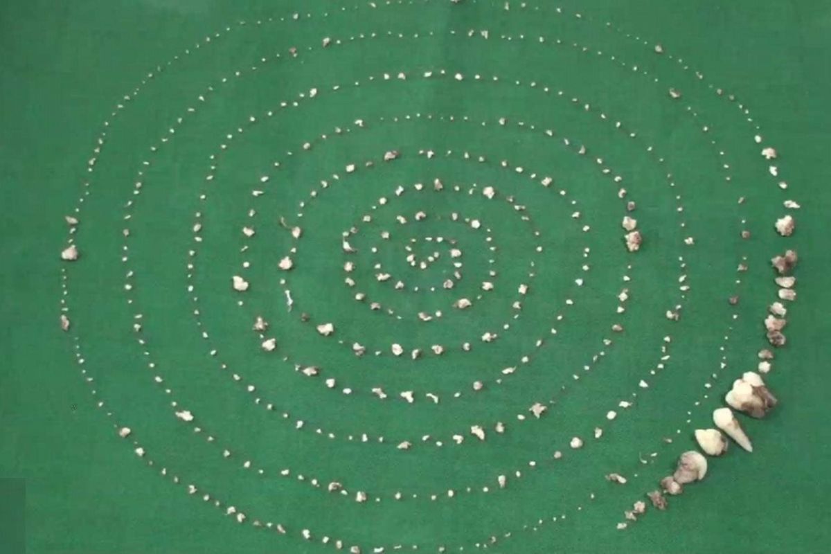 Menino indiano com 526 dentes submetido a cirurgia rara expõe falhas de acesso a exames precoces e coloca em xeque sistema de saúde infantil local