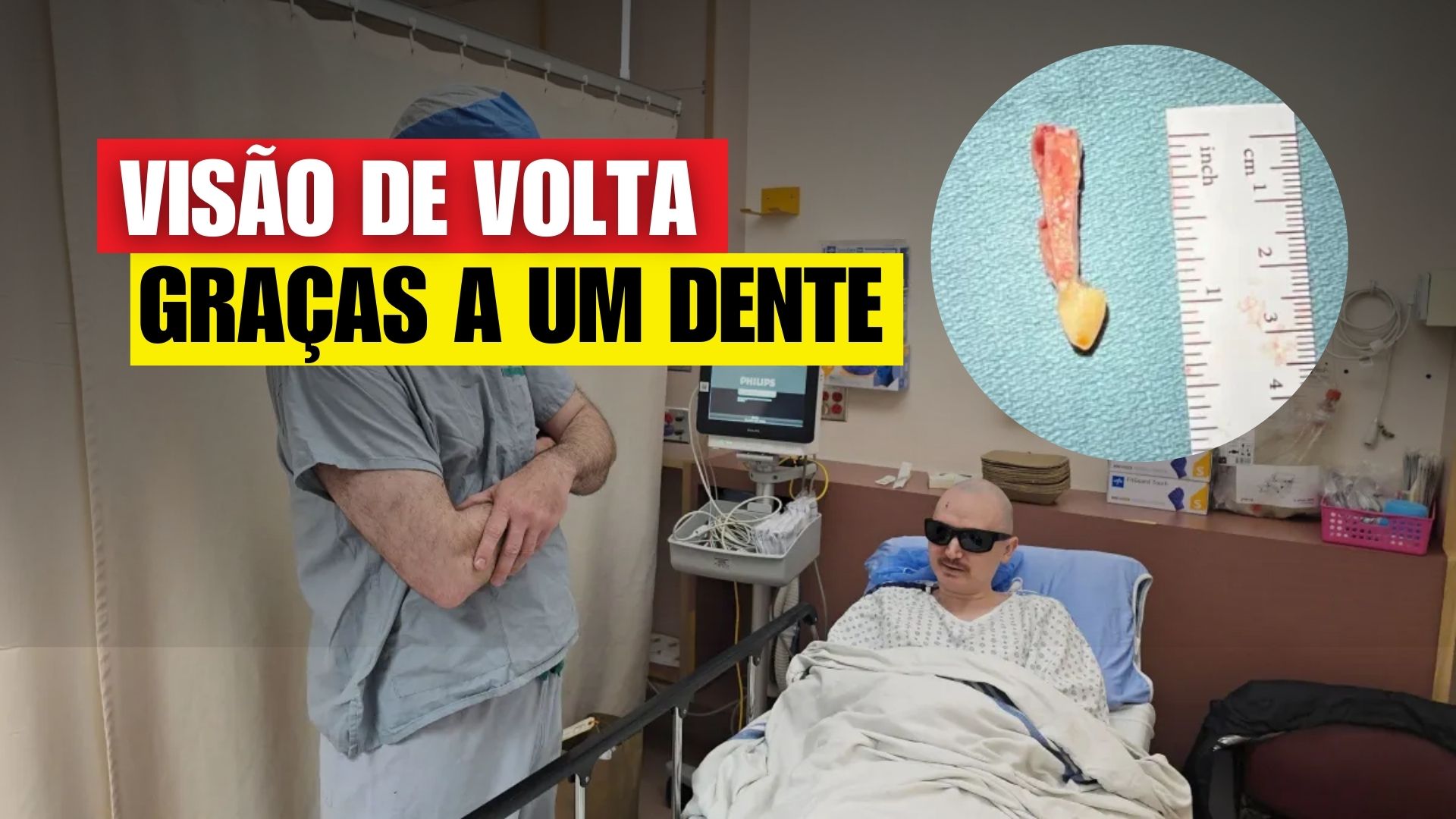 Homem volta a enxergar após 20 anos de cegueira com rara cirurgia que usa um dente para sustentar lente no olho. Técnica inédita no Canadá.