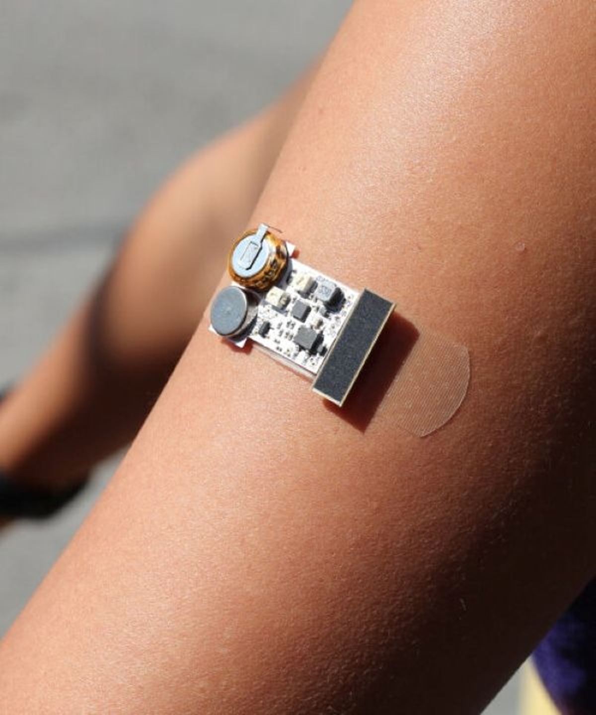 Adesivo inteligente sem bateria alerta com vibração ao detectar excesso de exposição solar, protegendo a pele e prevenindo doenças graves.