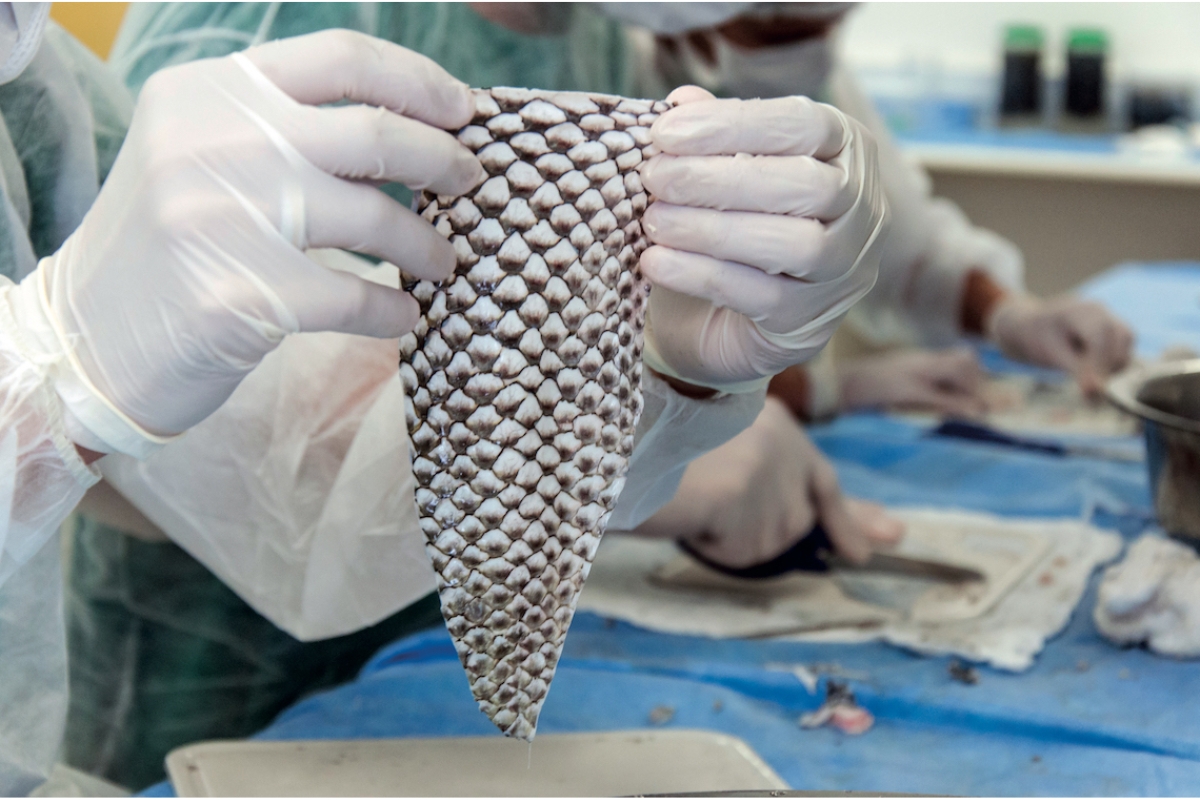 Parece improvável, mas é real: a pele de um peixe comum no Brasil está sendo usada como “pele temporária” em queimaduras, com mais conforto e menos manipulação da ferida