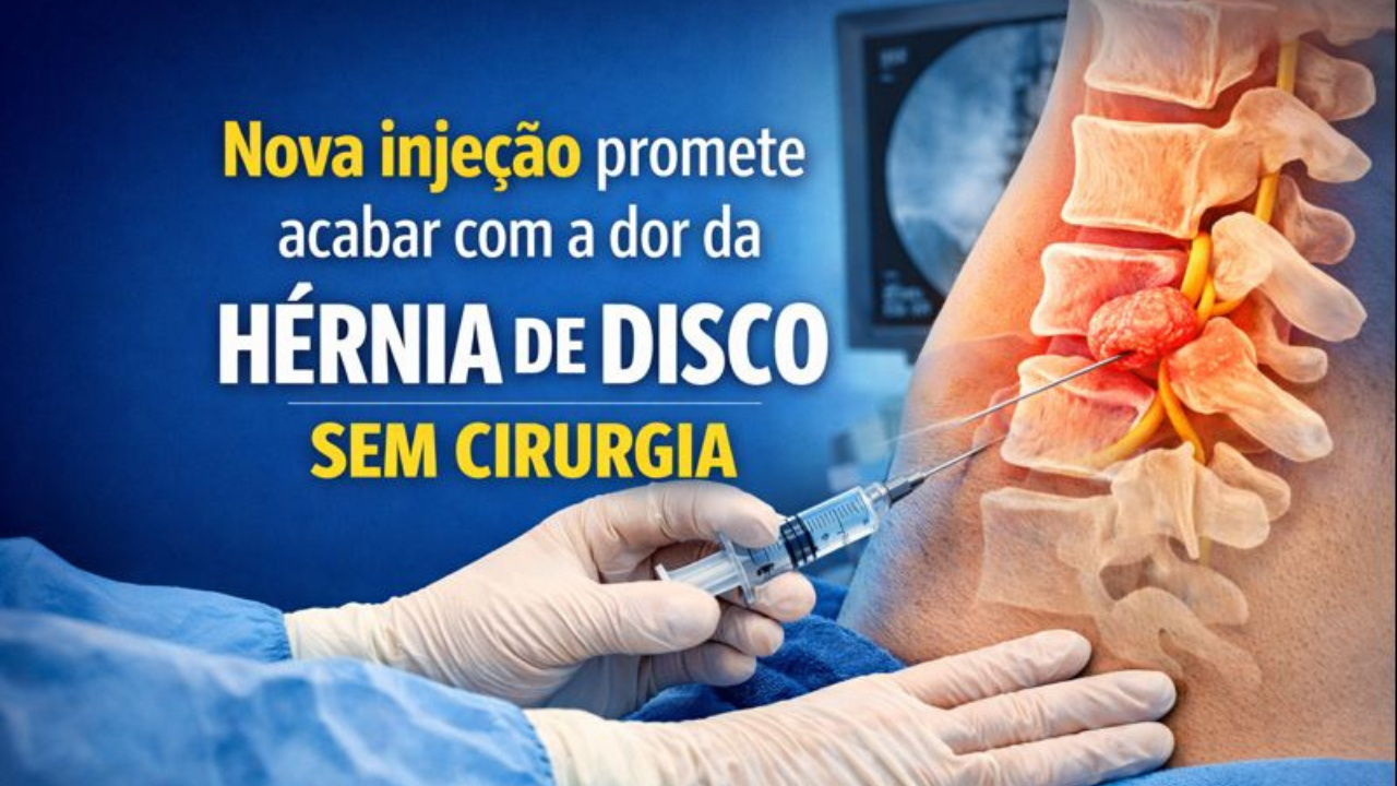 Tratamento com injeção na coluna reduz dor da hérnia de disco e a compressão nervosa, segundo pesquisa publicada em revista científica.
