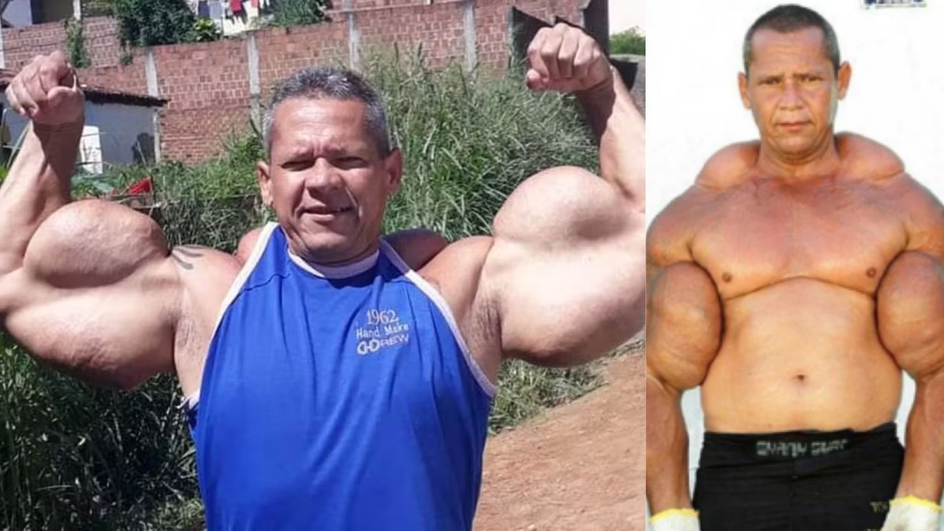 Arlindo Anomalia, o Popeye brasileiro, com braços extremamente musculosos que chamaram atenção na internet.