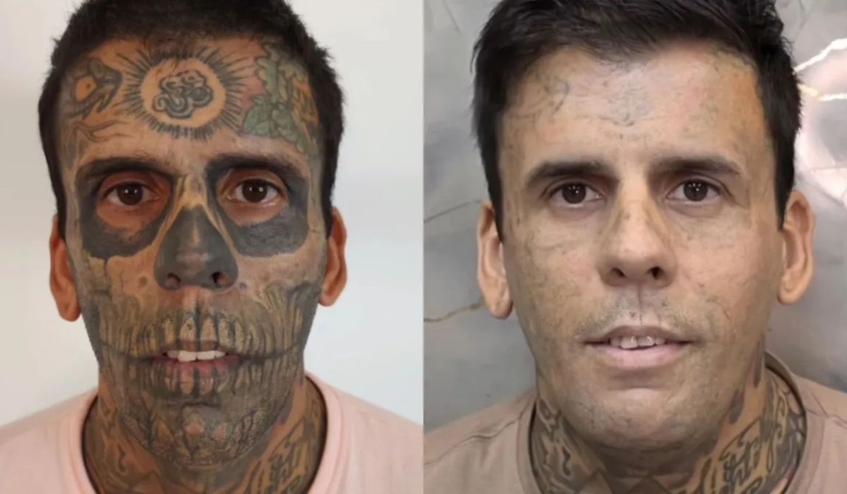 Leandro Souza, conhecido como o mais tatuado do Brasil, faz 6ª remoção a laser e relata conversão, fim de vícios e plano missionário. (Imagem: Reprodução/CNN)